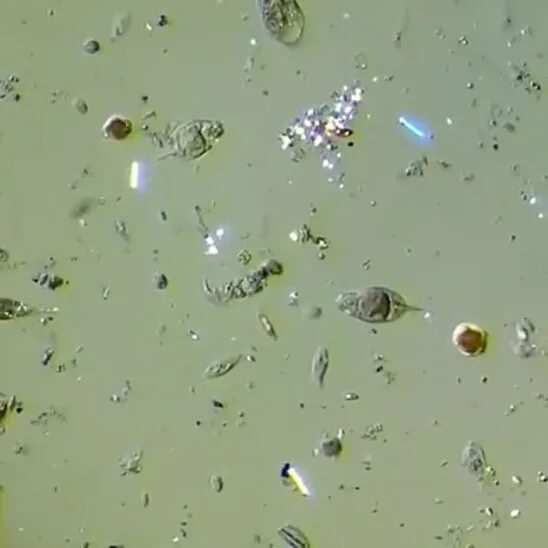 Капля воды под микроскопом фото Одноклассники