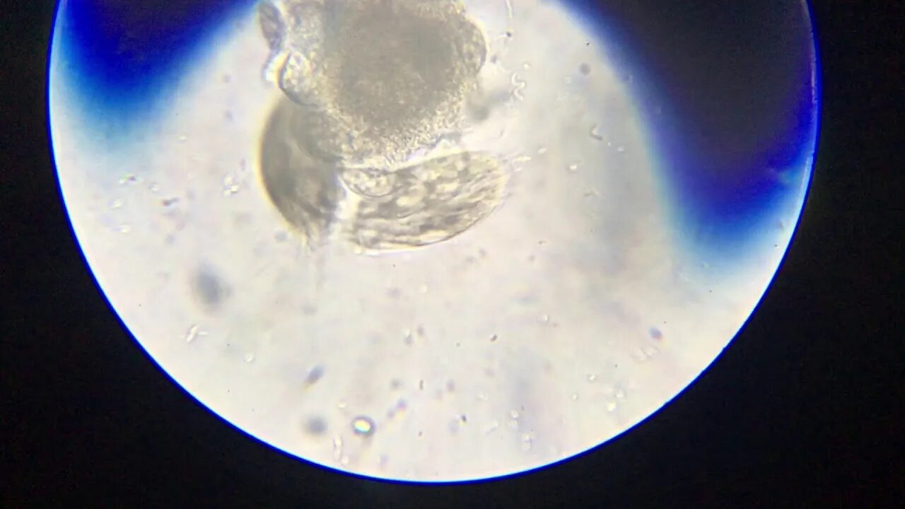 Капля воды под микроскопом фото Капля воды из вазы с цветами под микроскопом - YouTube