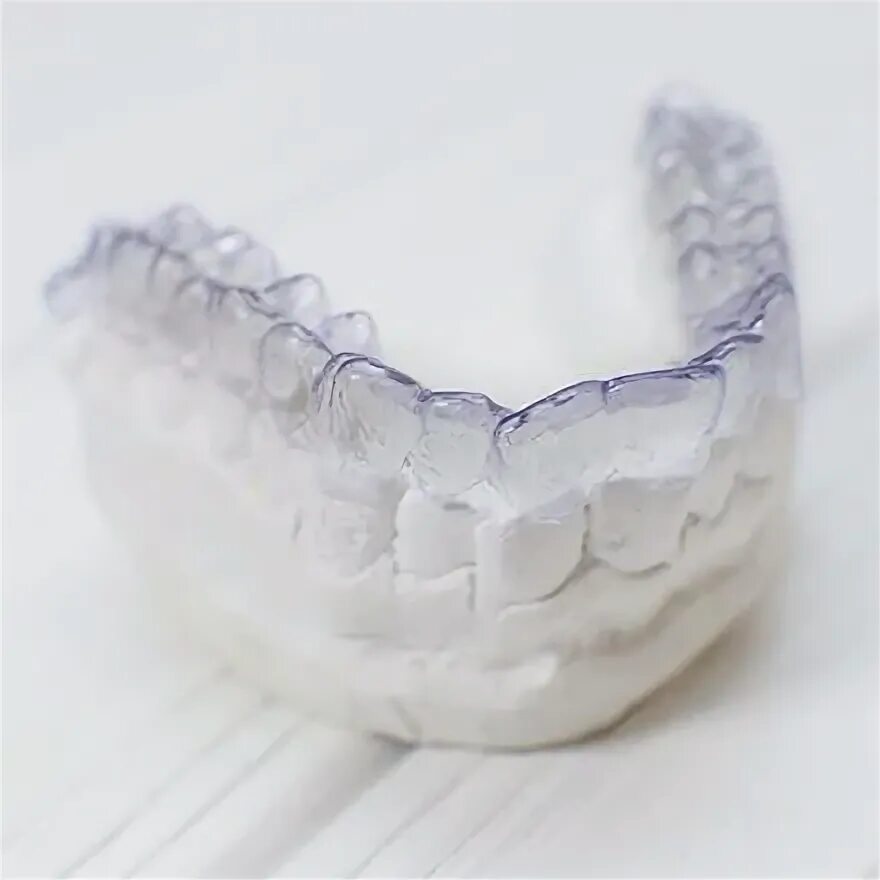 Каппа для зубов фото Invisalign South Loop, Chicago Clear Braces Orthodontist