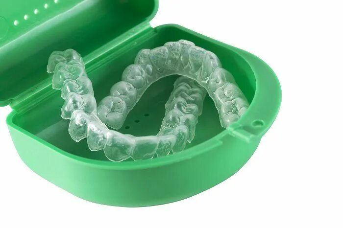 Каппа для зубов фото Pin on Edmonds Pediatric Dentist
