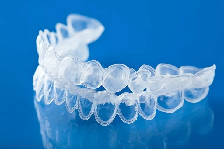 Каппа для зубов стоматологическая как выглядит Pin on Dental Health