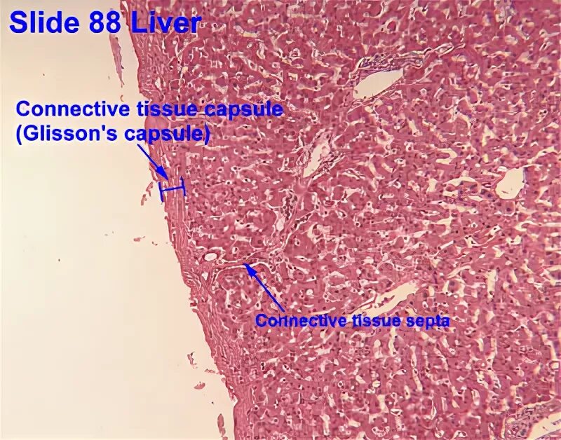 Капсула печени фото Liver Gall bladder Pancreas