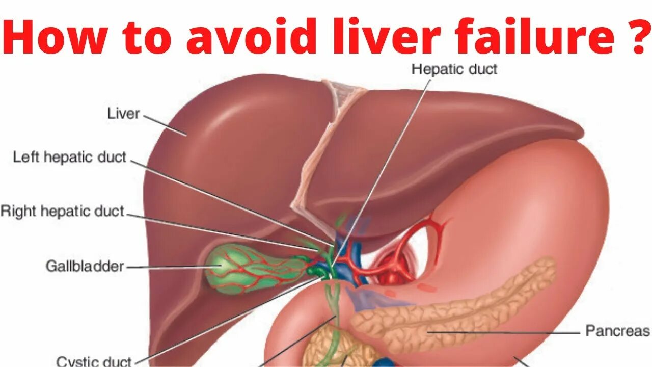 Капсула печени фото How to avoid a fatty liver? World liver day XPLUS - YouTube
