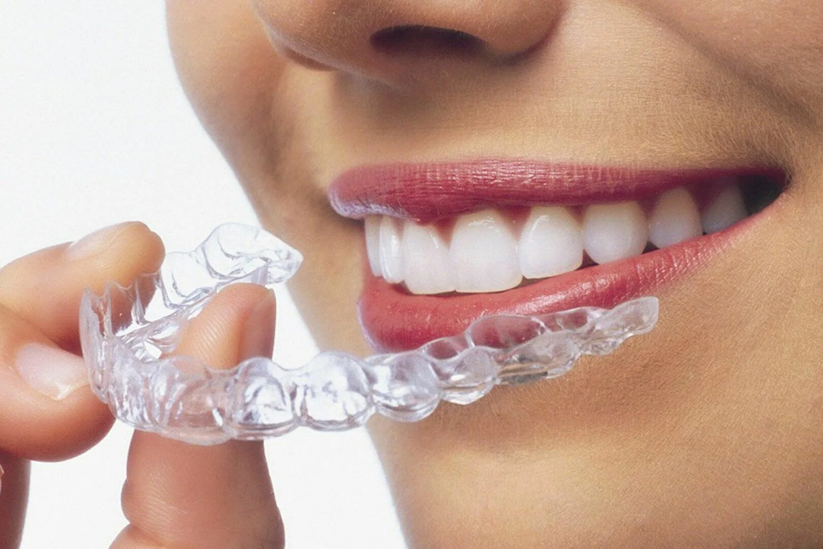 Капы для выравнивания зубов фото Aligners Invisalign in Dubai - Full treatment with Vie Clinic