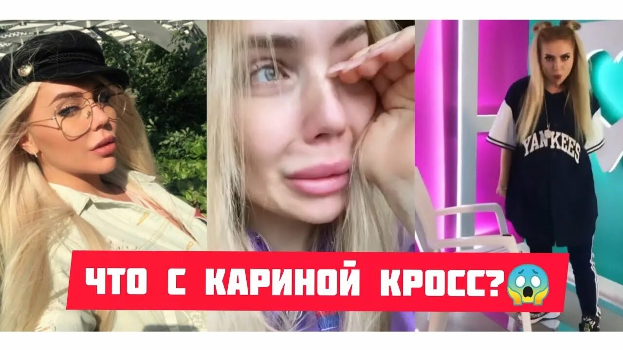 Кара кросс фото до пластики Карина кросс до пластики фото - ViktoriaFoto.ru