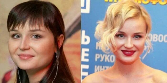 Караулова до и после пластики фото Караулова до и после пластики: найдено 87 изображений
