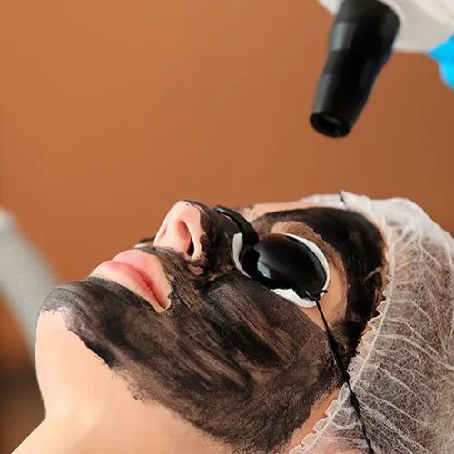Карбоновый пилинг для лица фото Skin Peels London - The Yuki Clinic London