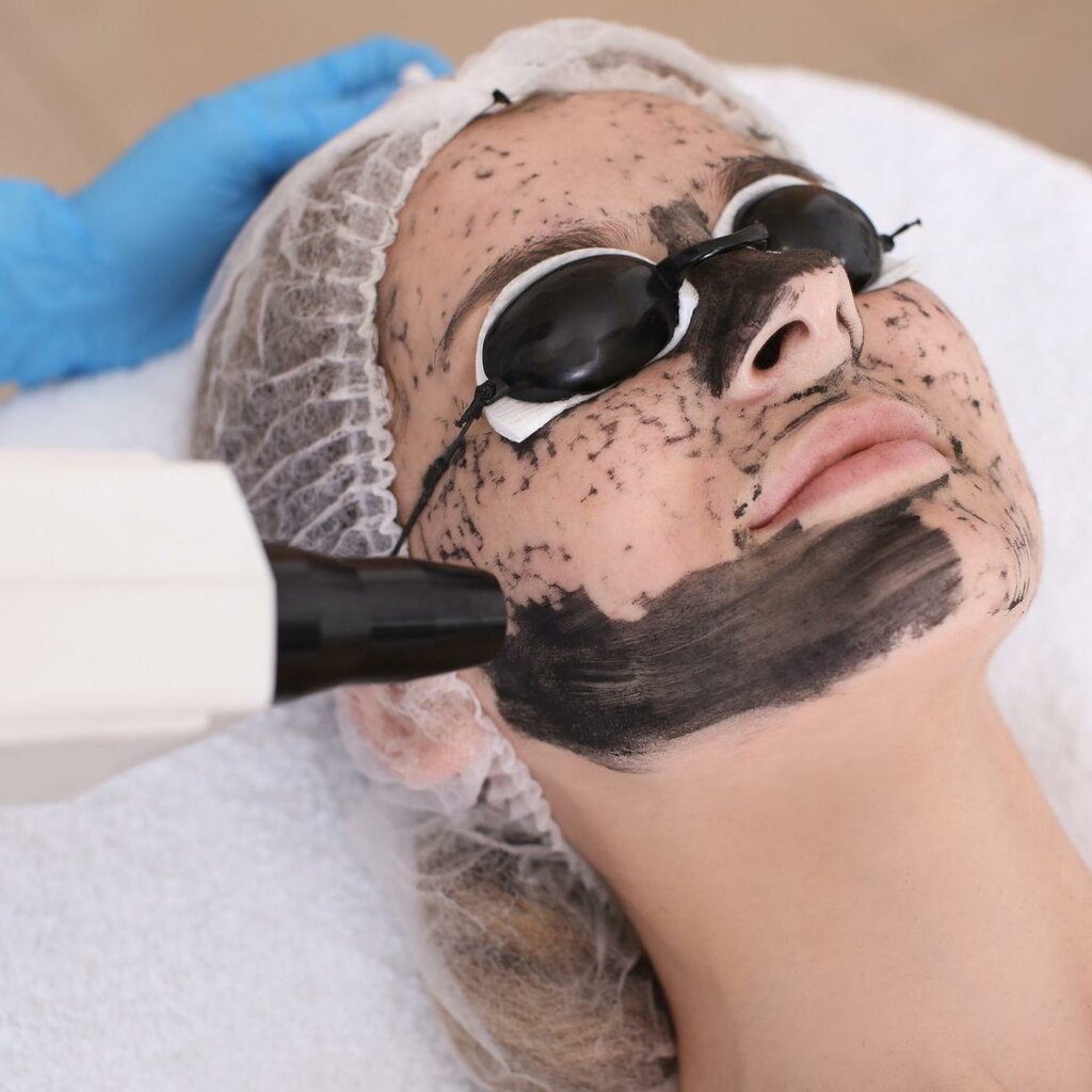 Карбоновый пилинг отзывы фото до и после Laser SM, эпиляция, ул. Смельчак, 7, микрорайон Кучино, Балашиха - Яндекс Карты