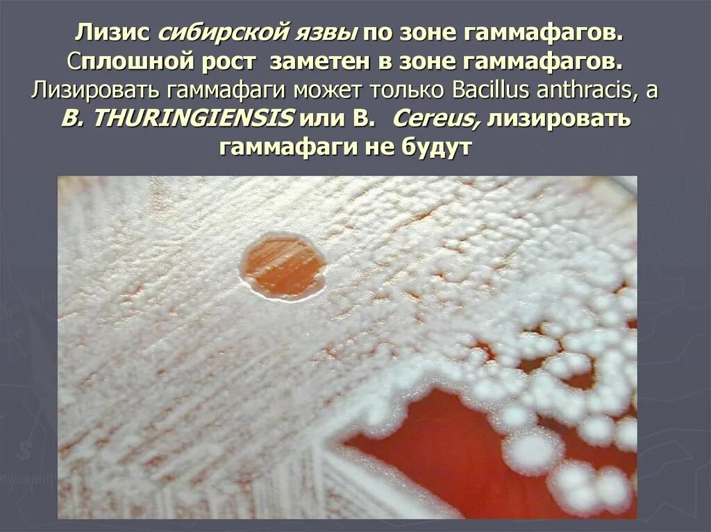 Карбункул при сибирской язве фото Особенности эпидемического процесса при сибирской язве - презентация онлайн