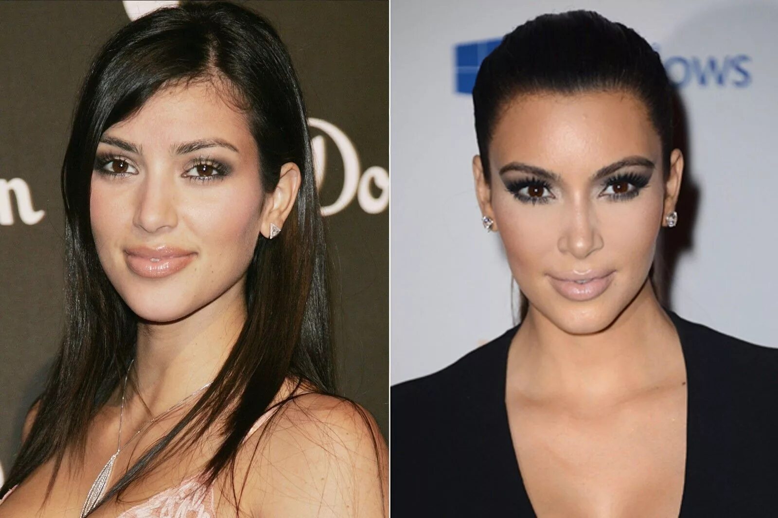 Кардашьян фото до пластики Kim Kardashian