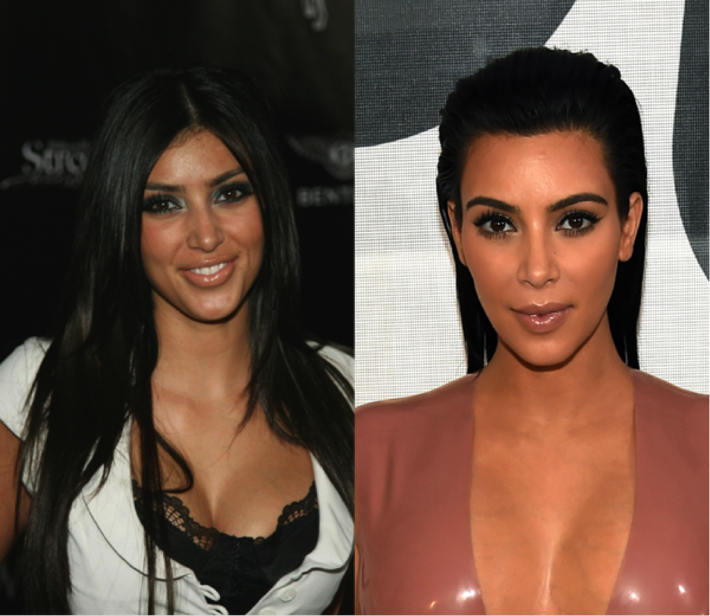 Кардашьян фото до пластики The Kardashians plastische chirurgie borstvergroting -ELLE.be
