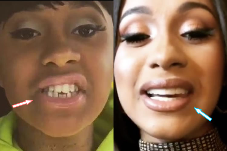 Карди би фото до и после пластики Cardi B Teeth Before and After: Cosmetic Procedure Comparison