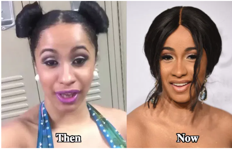 Карди би фото до и после пластики Before - After Cardi B Cardi b, Top rappers, Cardi