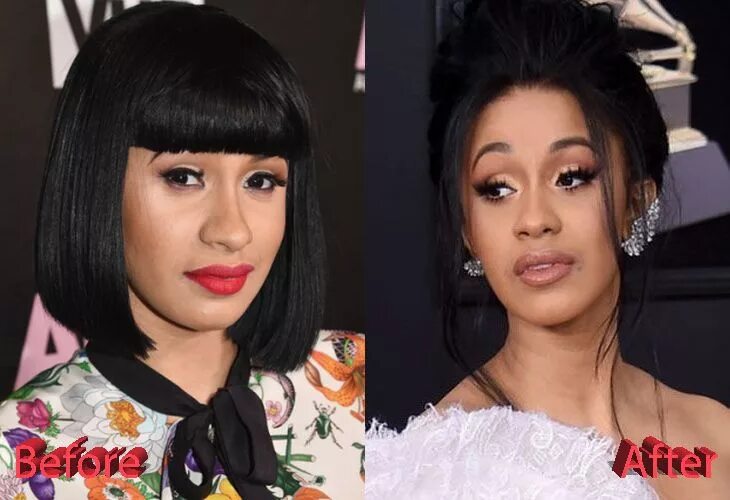 Карди би фото до и после пластики Cardi B Before and After Plastic Surgery Plastic surgery, Cardi b, Celebrity pla