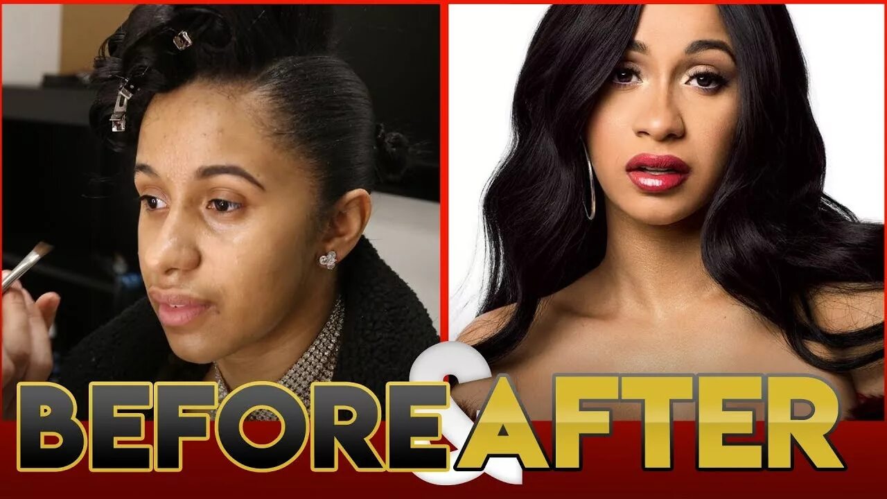 Карди би фото до и после пластики CARDI B BEFORE & AFTER TRANSFORMATION ( Plastic Surgery ) - YouTube