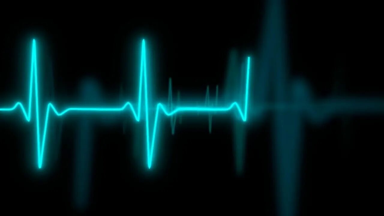 Кардиограмма сердца фото baatein ye kabhi na love cover - YouTube