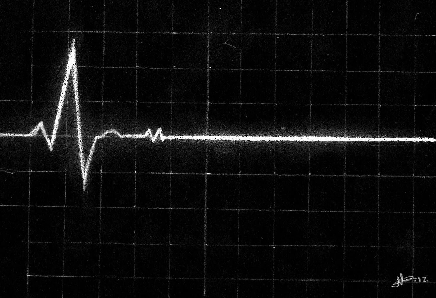 Кардиограмма сердца фото человека Terminal Window / Radio Logo Radio, Windows, Message board
