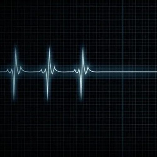 Кардиограмма сердца фото человека Stream Back when I feel like - Beano by Beano Listen online for free on SoundClo