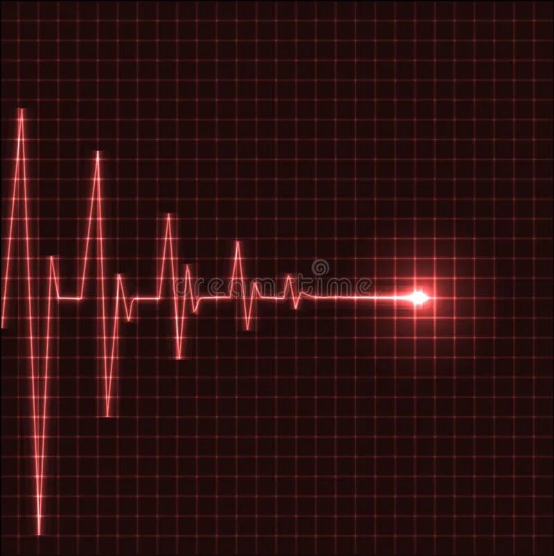 Кардиограмма сердца фото человека Abstract Heart Beats Cardiogram Stock Illustration - Illustration of healthcare,