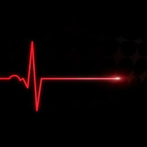 Кардиограмма сердца фото человека Stream Deejays Koma music Listen to songs, albums, playlists for free on SoundCl