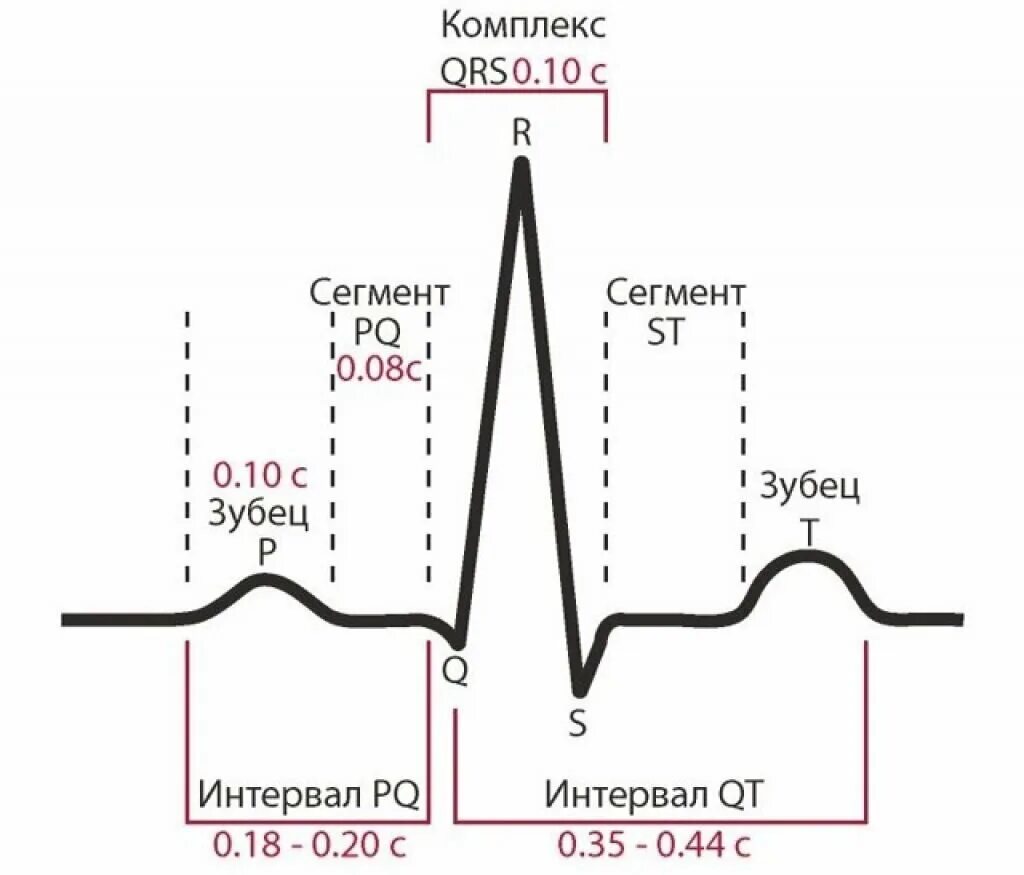 Кардиограмма сердца норма фото КАК ПРОЧИТАТЬ ЭКГ? Weird_Med_Student Дзен