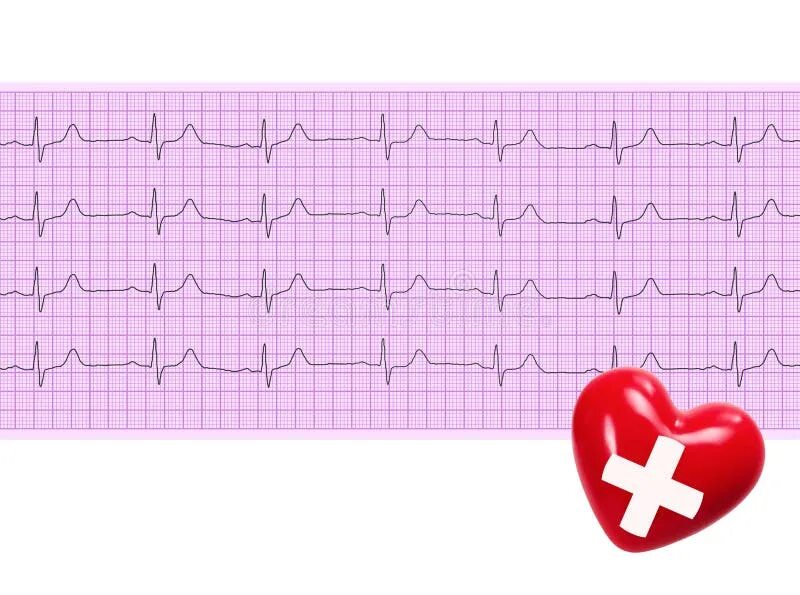 Кардиограмма сердца нормальная фото как выглядит Heart Analysis, Electrocardiogram Graph ECG in Hand Doctor at the Hospital Stock