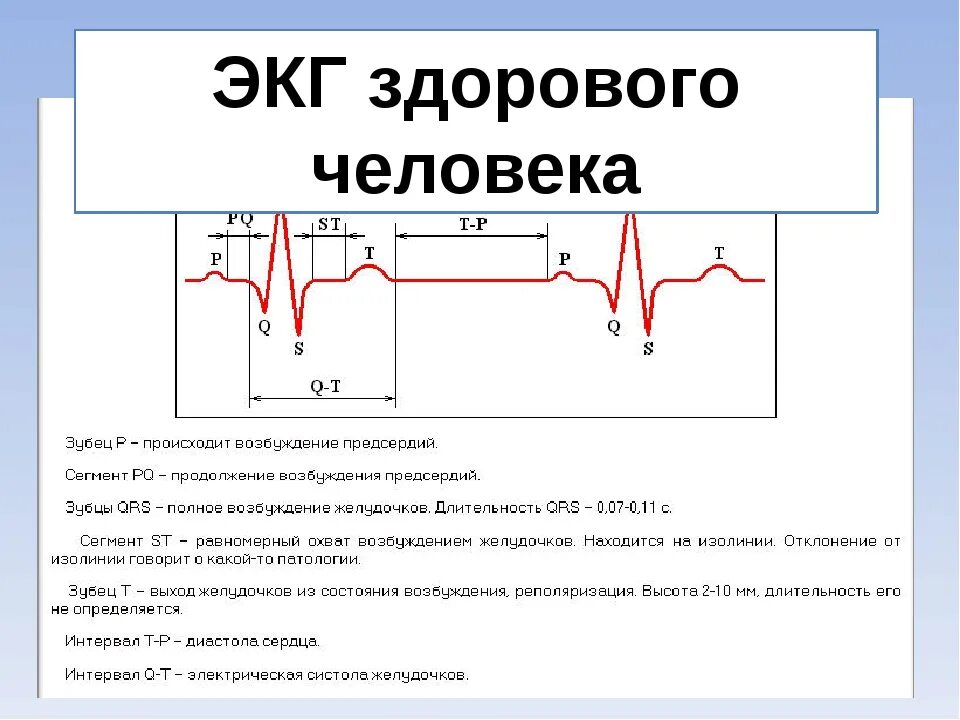 Кардиограмма сердца нормальная фото как выглядит Экг санкт петербург