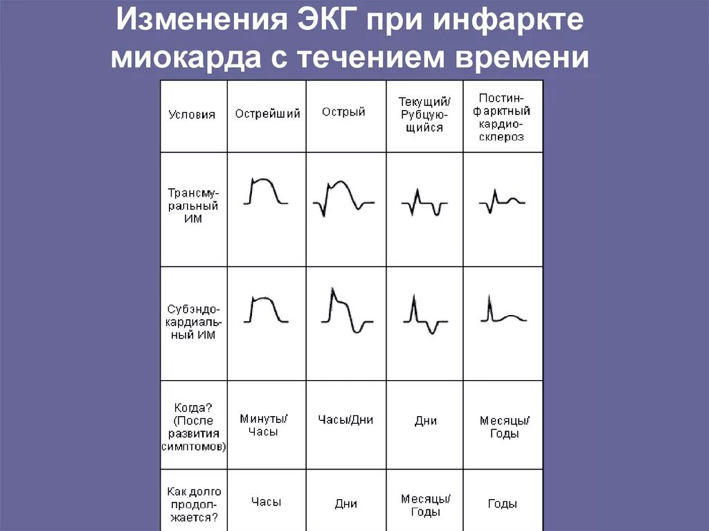Кардиограмма сердца при инфаркте фото расшифровка Los Santos Hospital Authority Basic life support and advanced life support - Арх