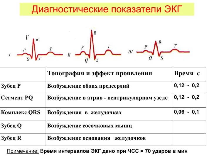Кардиограмма сердца при инфаркте фото расшифровка Что значит синусовый ритм сердца на экг