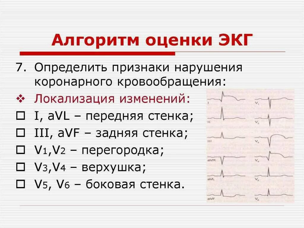 Кардиограмма сердца расшифровка фото Диагнозы экг сердца