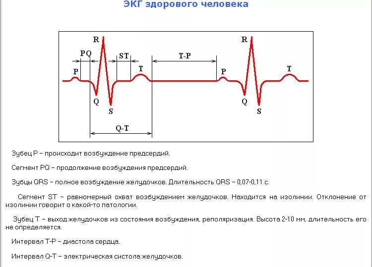 Кардиограмма сердца расшифровка фото Прочитать экг сердца