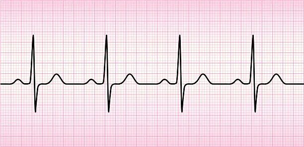 Кардиограмма сердца здорового человека фото Более 12 400 работ на тему "Heart Rate Chart Pulse": стоковые иллюстрации, векто