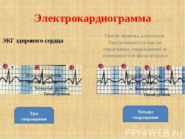 Кардиограмма сердца здорового человека фото Презентация по Химии ""Алкоголь - вещество наркотическое"." - скачать смотреть б