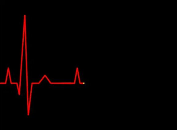 Кардиограмма сердца женщина фото Heartbeat monitor Aesthetic gif, Love gif, Motion design animation