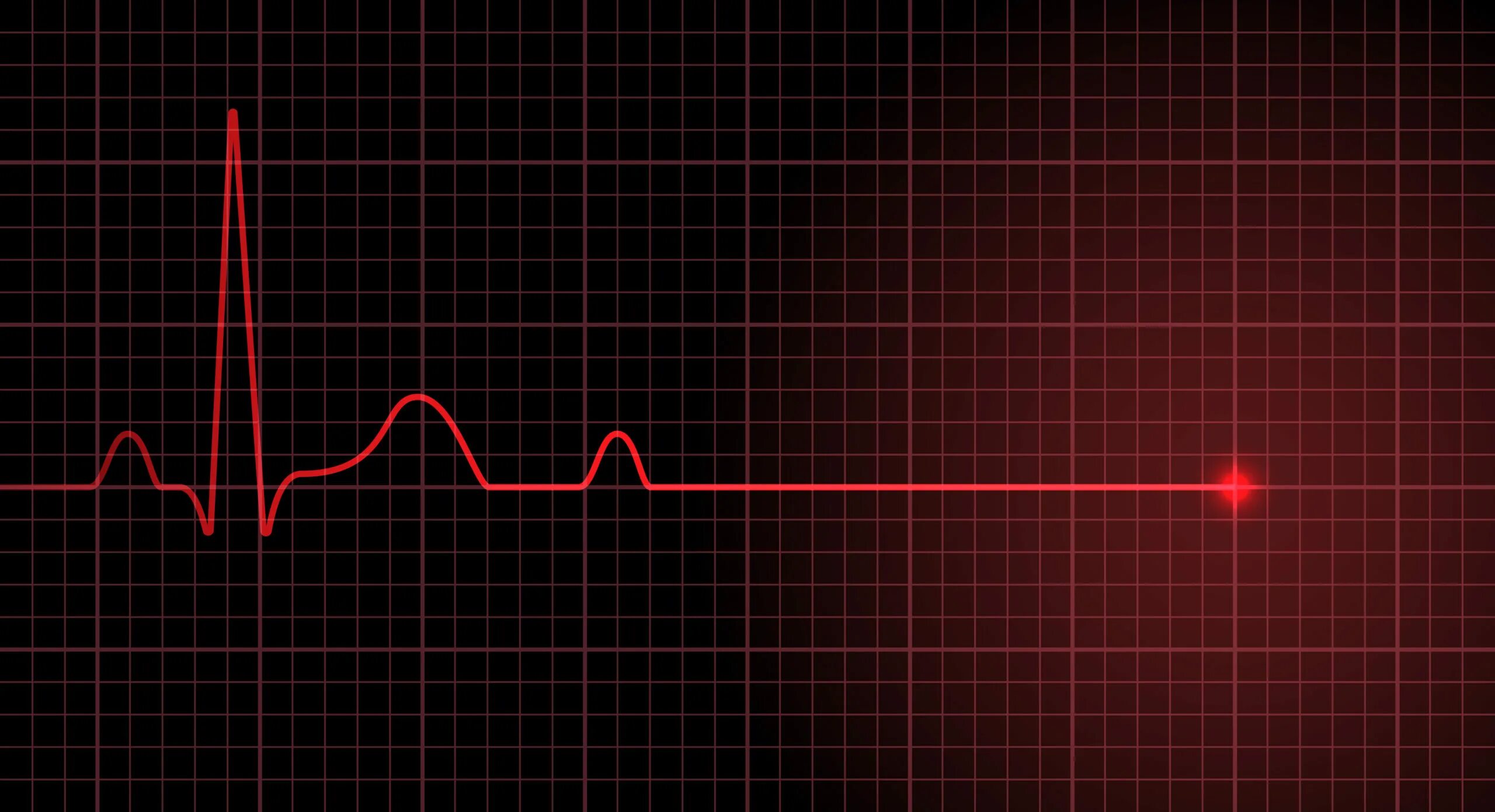 Кардиограмма сердца женщина фото America's ailing health care system: How it's failing patients and doctors