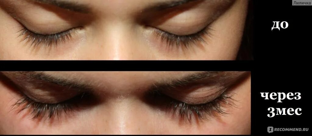 Карепрост для ресниц отзывы фото Средство для роста и укрепления ресниц Careprost Bimatoprost Ophthalmic Solution