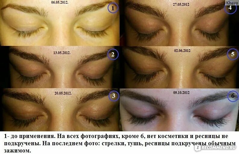 Карепрост для ресниц отзывы фото Средство для роста и укрепления ресниц Careprost Bimatoprost Ophthalmic Solution