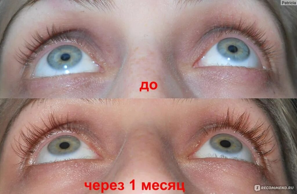 Карепрост отзывы фото и после ресницы Средство для роста и укрепления ресниц Careprost Bimatoprost Ophthalmic Solution