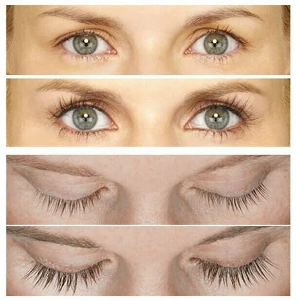 Карепрост отзывы фото и после ресницы Dreamlash Сыворотка для роста ресниц Eyelash Serum, 4 мл - купить в интернет-маг