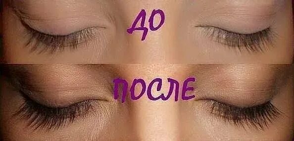 Карепрост отзывы фото и после ресницы Careprost - средство для роста ресниц Карепрост - купить в Екатеринбурге, цена 8