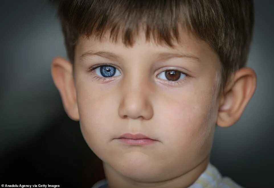 Карие глаза мальчика фото Brothers are born with stunning DIFFERENT-coloured eyes Daily Mail Online