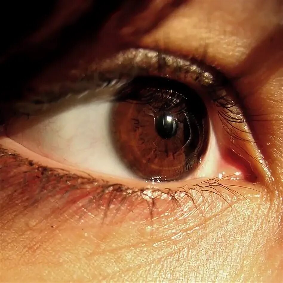 Карие глаза на солнце фото Captivating Ideas for Brown Red Eyes