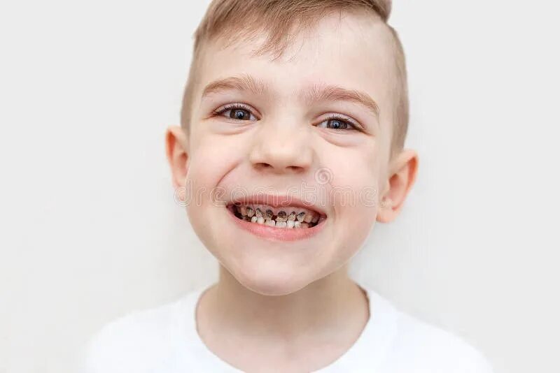 Кариес на молочных зубах у детей фото 16,941 Dental Boy Stock Photos - Free & Royalty-Free Stock Photos from Dreamstim