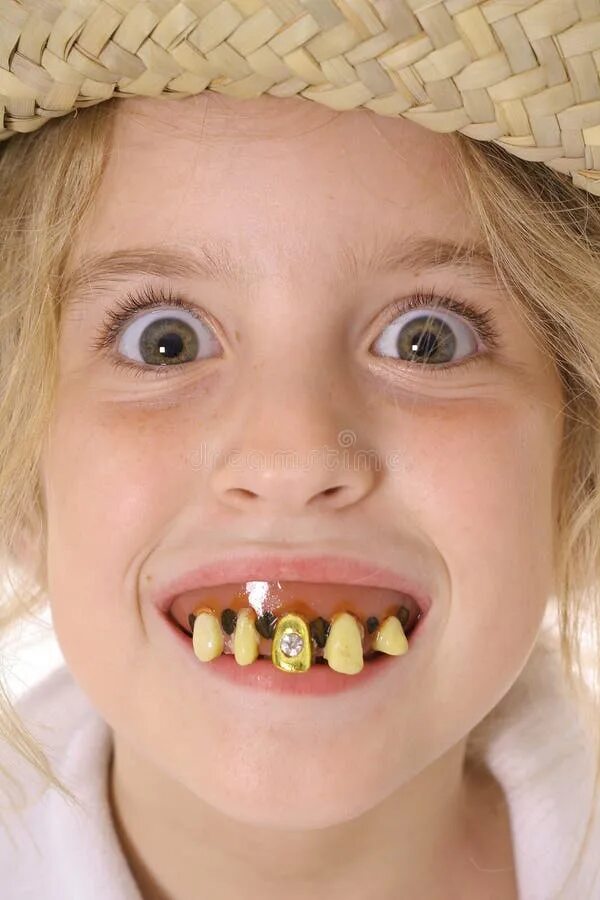 Кариес у детей фото стадии Cocky Ugly Man with Rotten Teeth Giving a Thumbs Up Stock Image - Image of lunat