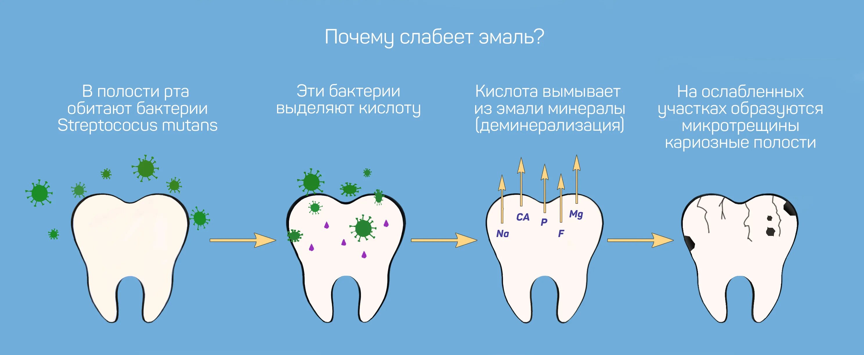 Кариес в стадии пятна фото Ознакомьтесь с Стерта эмаль зубов что делать
