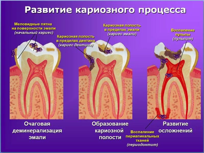 Кариес зубов фото у взрослых лечение "ОГАУЗ Томская областная клиническая больница (ТОКБ)"
