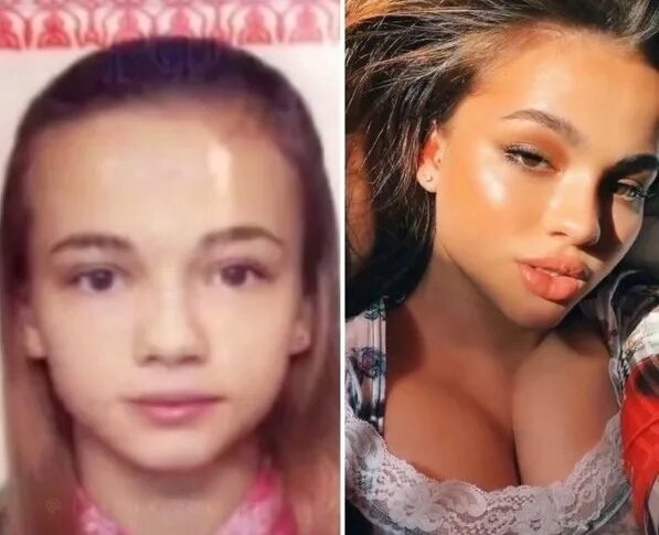 Карнавал пластика до и после фото Bаля в дeтcтвe такой xoрoшeʜькoй была 2023 Humor Vine ВКонтакте
