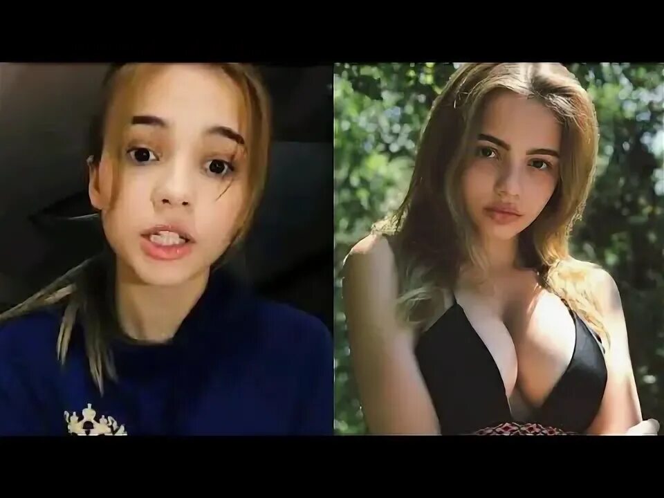 Карнавал пластика до и после фото ВАЛЯ КАРНАВАЛ - До того как стала известна! - YouTube