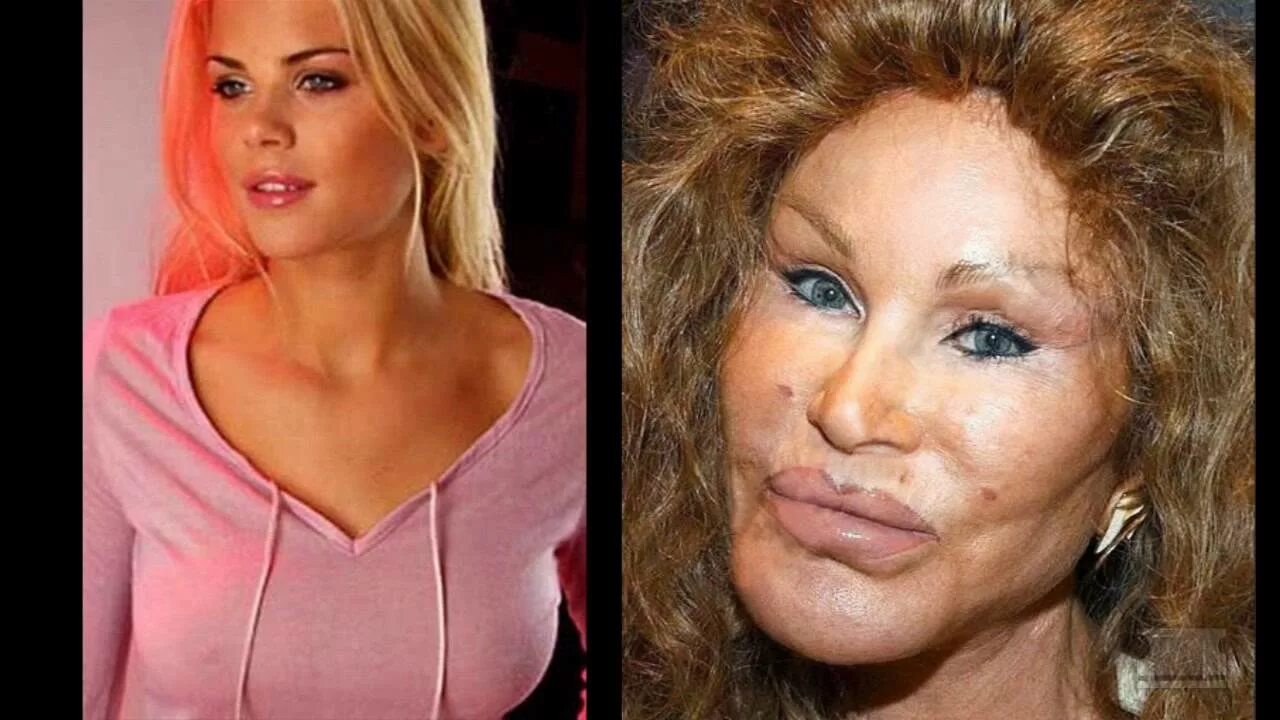 Карнавал пластика до и после фото Pod People - A Walk on the Wildenstein - YouTube