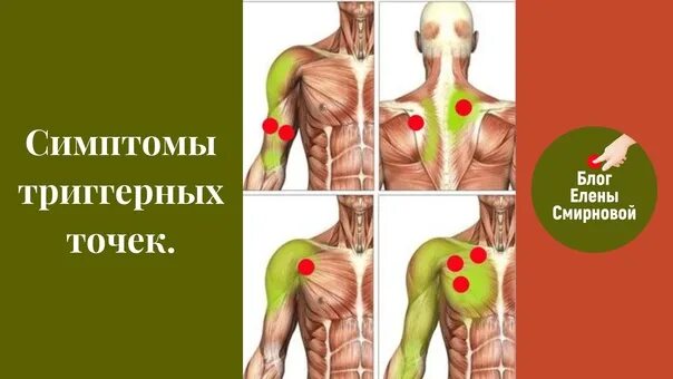 Карта триггерные точки фото ВКонтакте